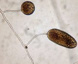 Two different spores belonging to one hypha (GA10)