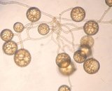 Cluster of spores (GA1)