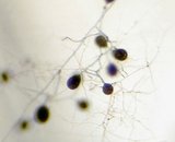 Extraradical spores and mycelium (GA3)