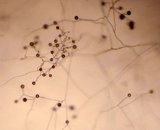 Extraradical spores and mycelium (GA4)