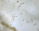 Extraradical spores and mycelium (GA5)