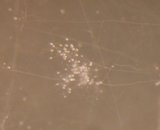 Cluster of spores (GA7)