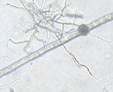 Spores developed in branched absorbing structures (GA9)