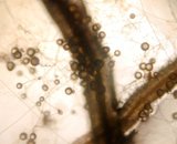 Extraradical spores (GC4)